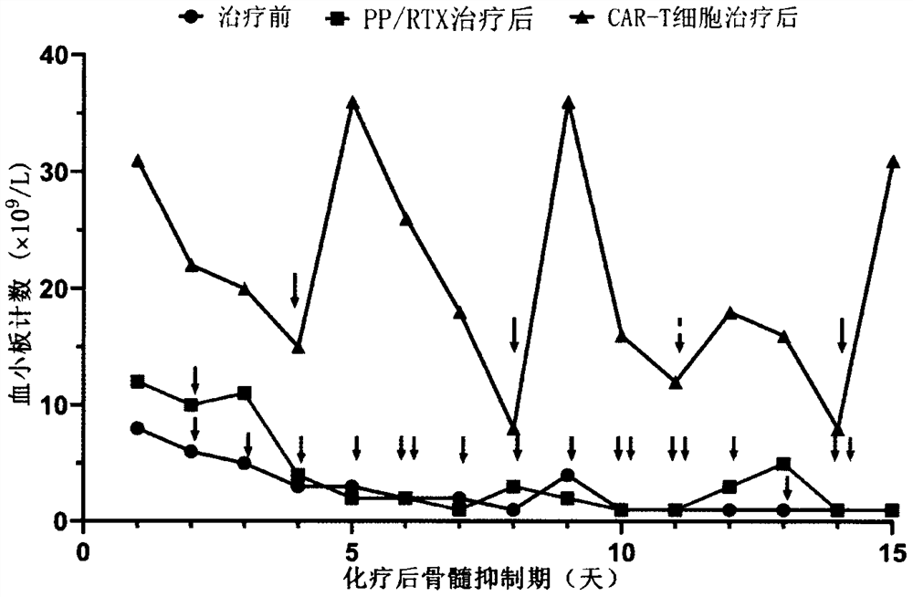 Combined application of sequential infusion CD19 CAR-T and BCMA CAR-T cells in immune-mediated platelet infusion invalidation of acute leukemia patients