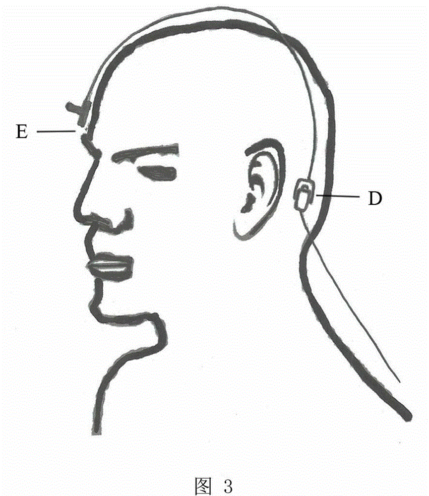 Otolith vibration therapy instrument