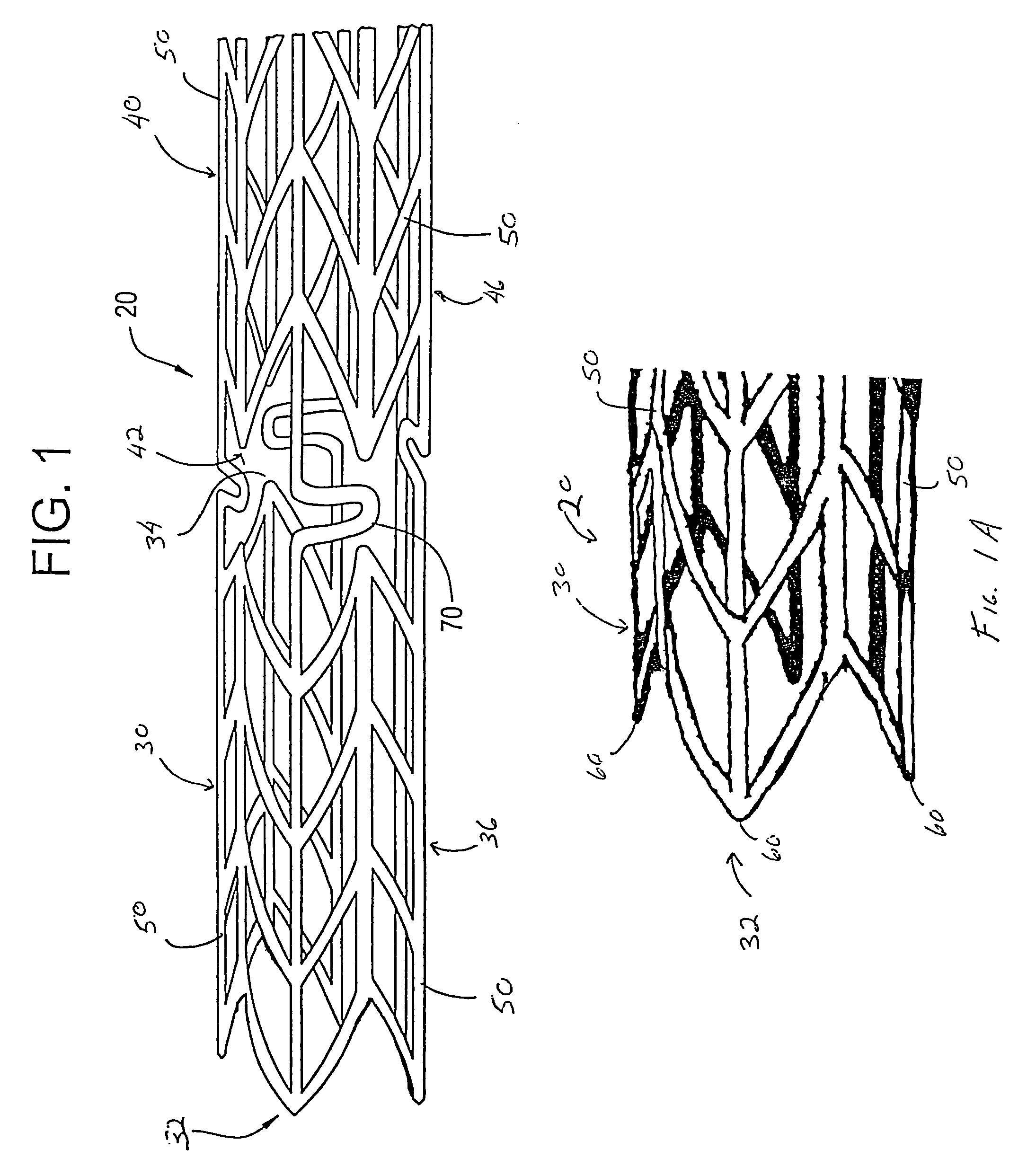 Irradiated stent coating