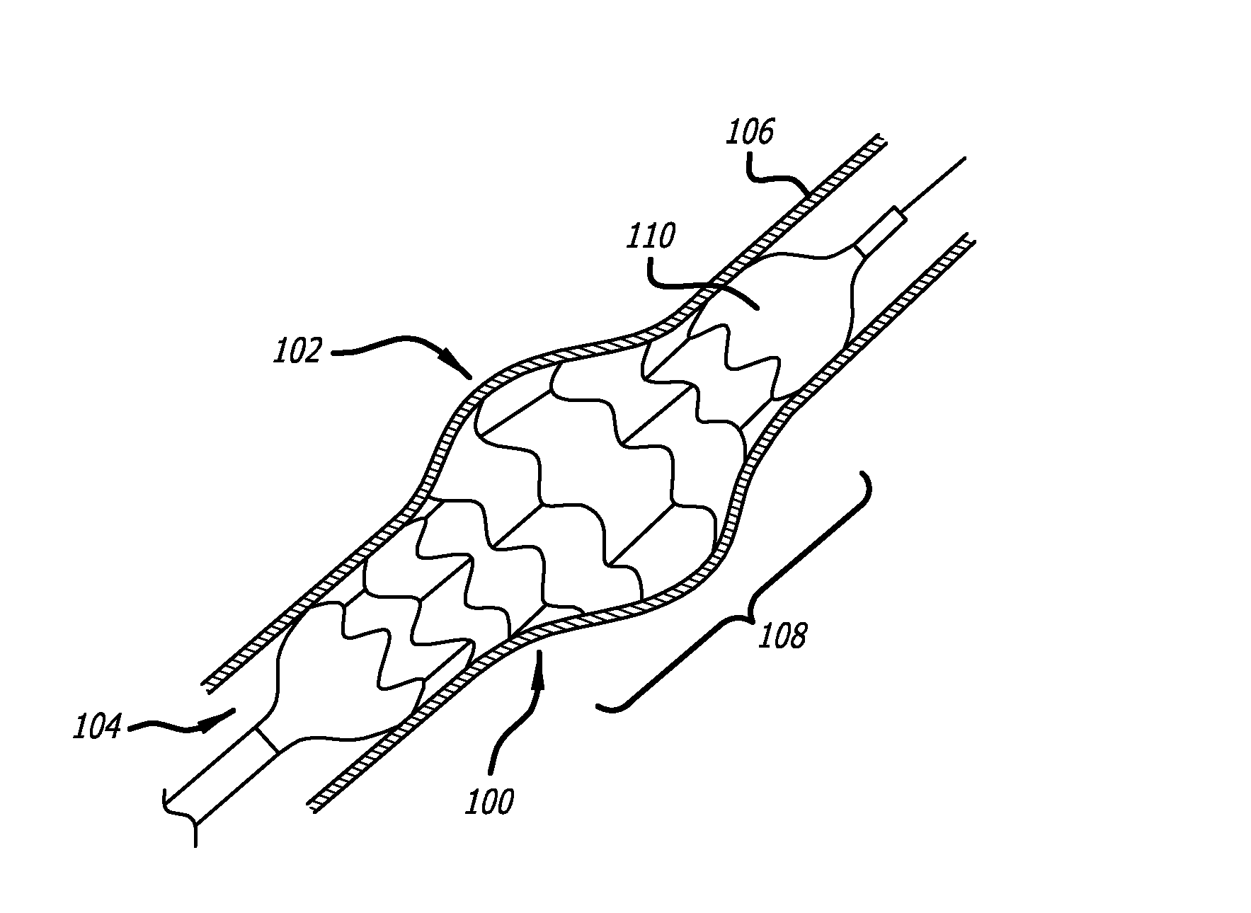 Intraluminal scaffold with conforming axial strut