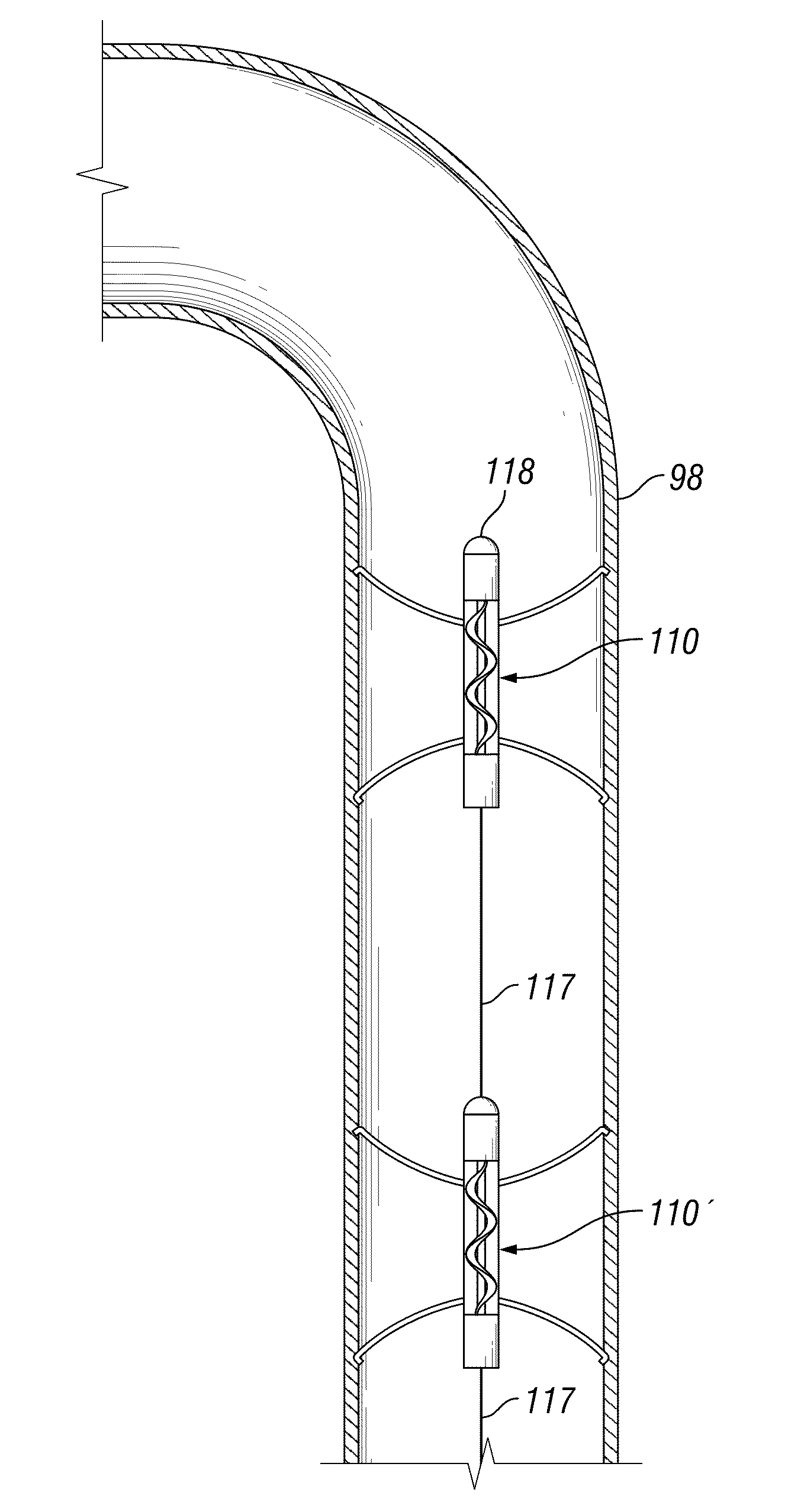 Systems and methods for fluid flows and/or pressures for circulation and perfusion enhancement