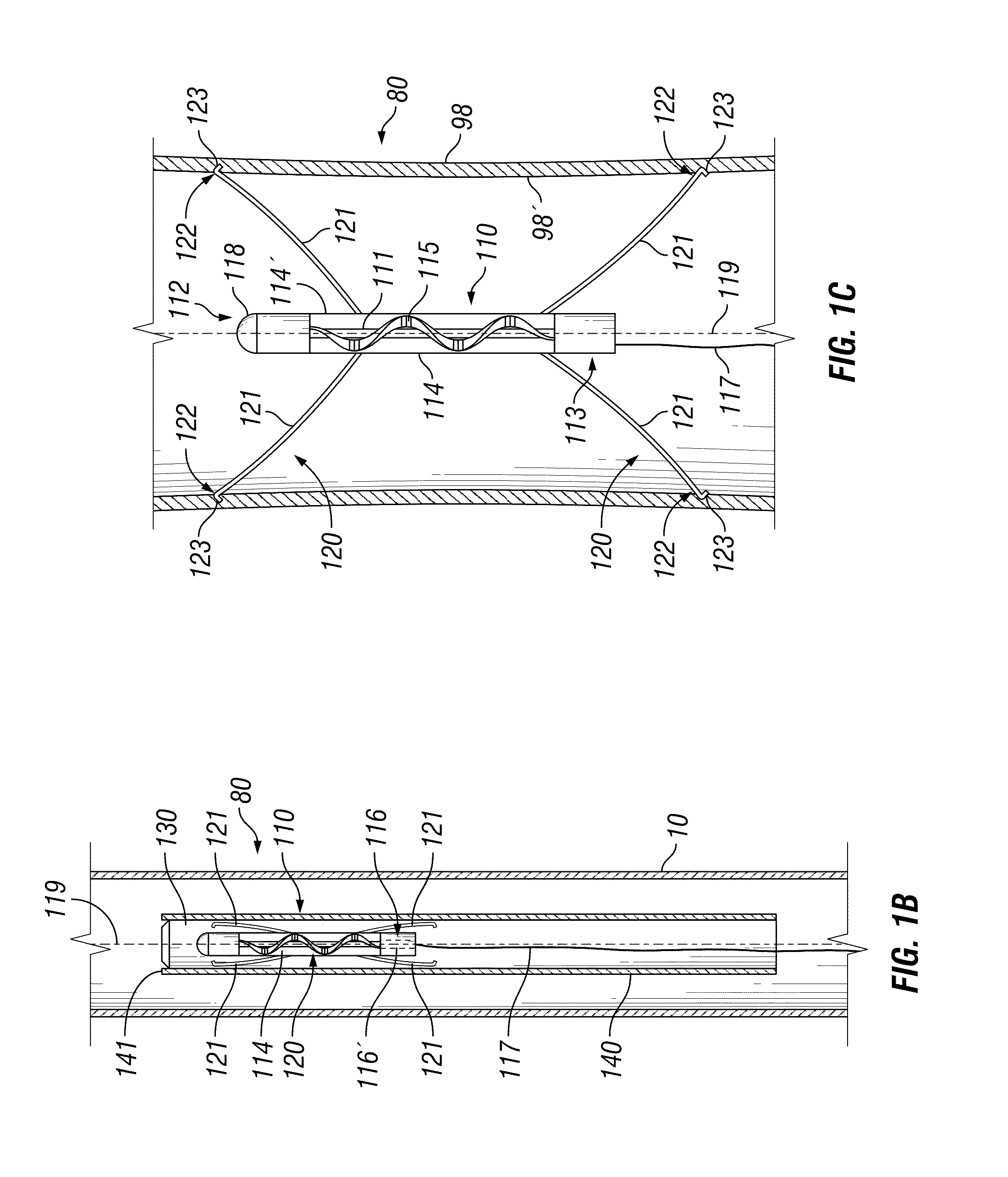Systems and methods for fluid flows and/or pressures for circulation and perfusion enhancement