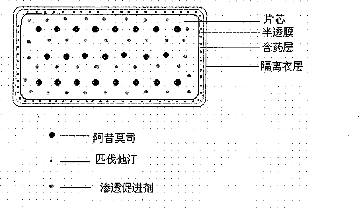 Osmotic pump preparation composition for treating hyperlipemia