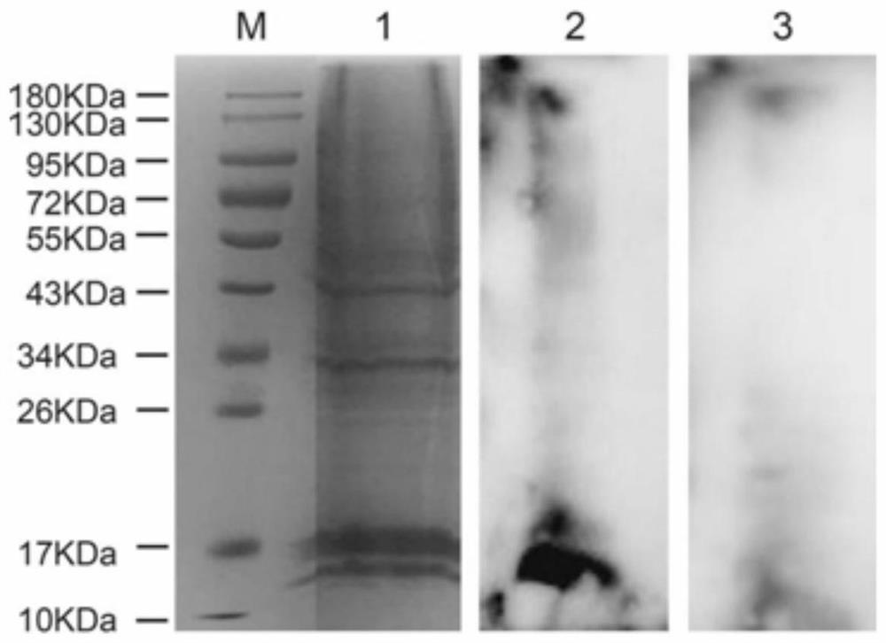 Receptor protein interacting with mycoplasma genitalium mgpa, isolation method and use thereof