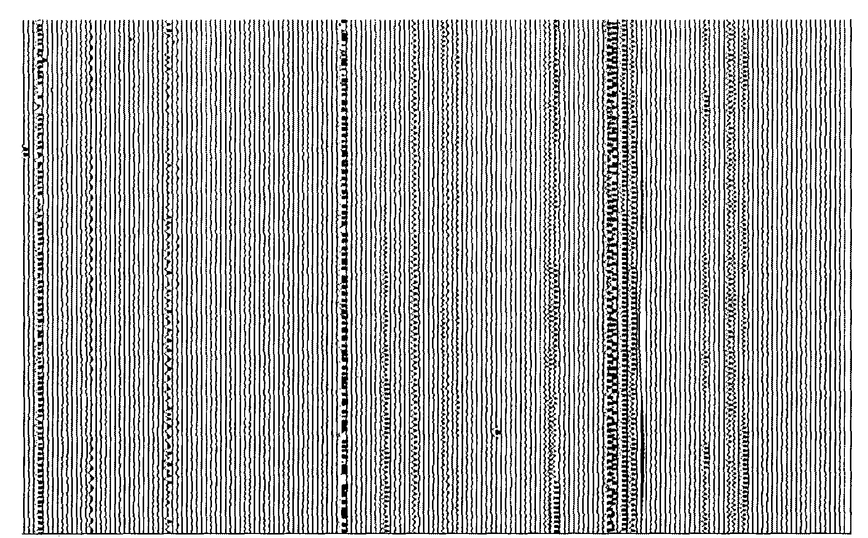 Method for removing abnormal noise in single-point reception of seismic record by digital detector