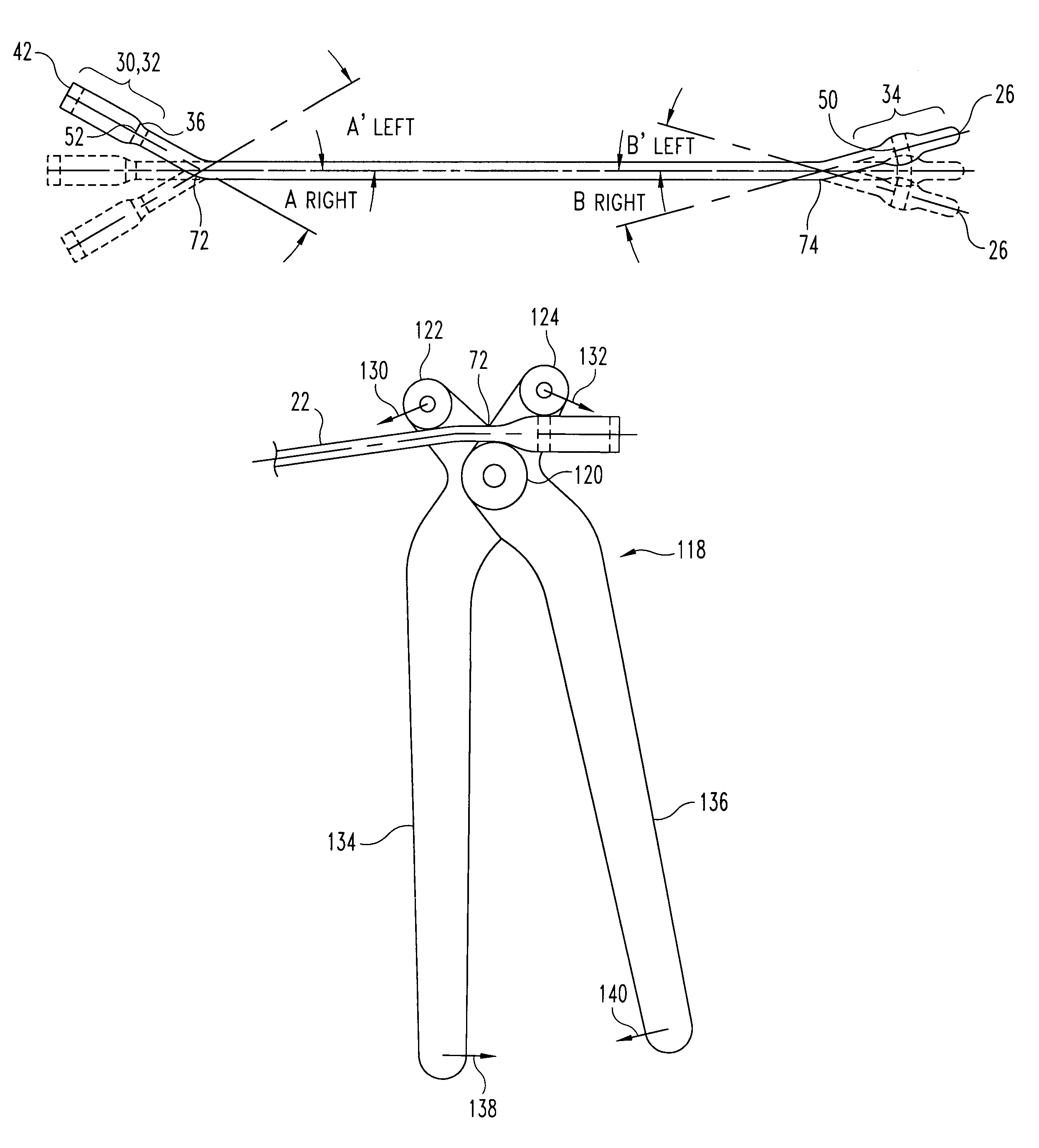 Pediatric intramedullary nail and method