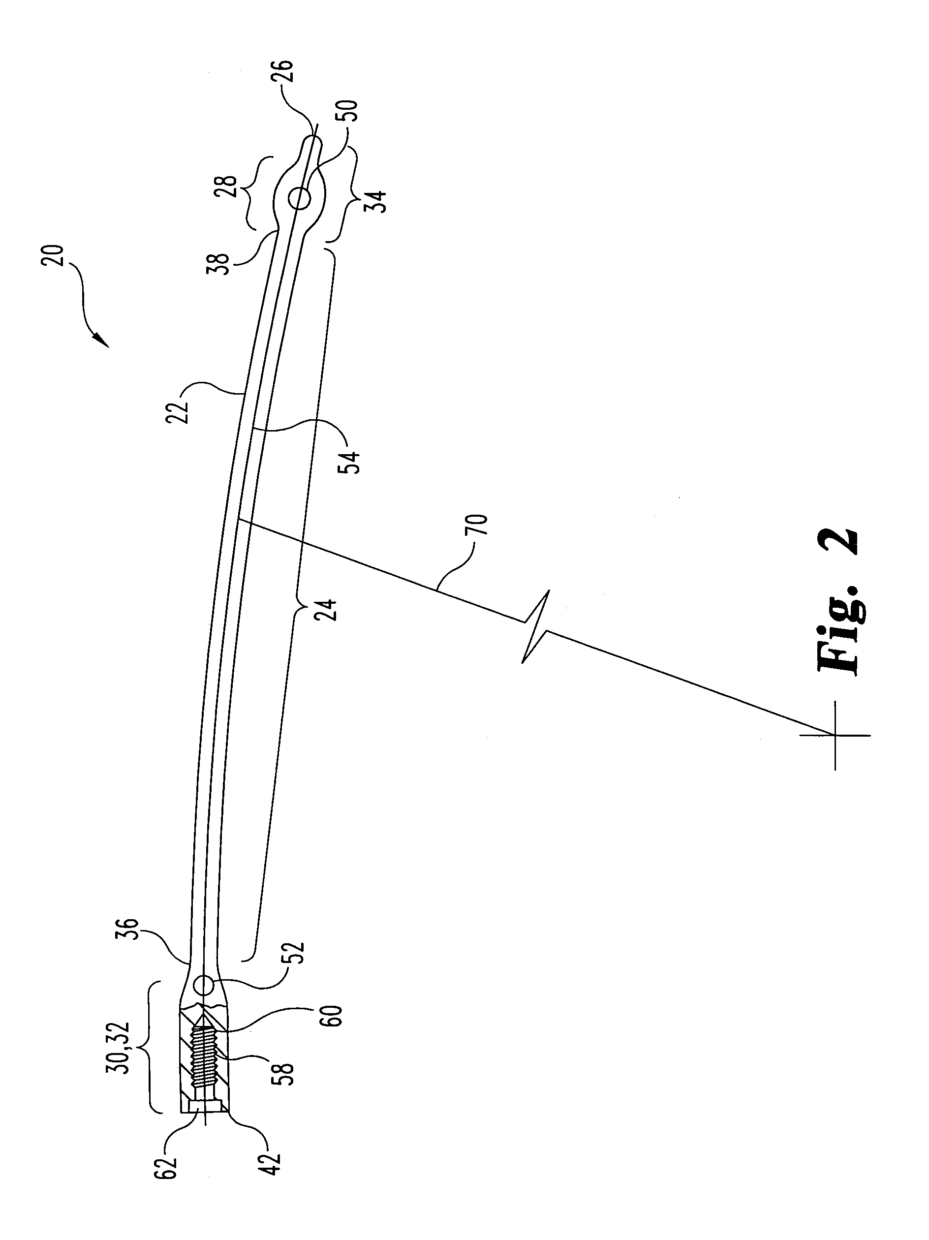 Pediatric intramedullary nail and method