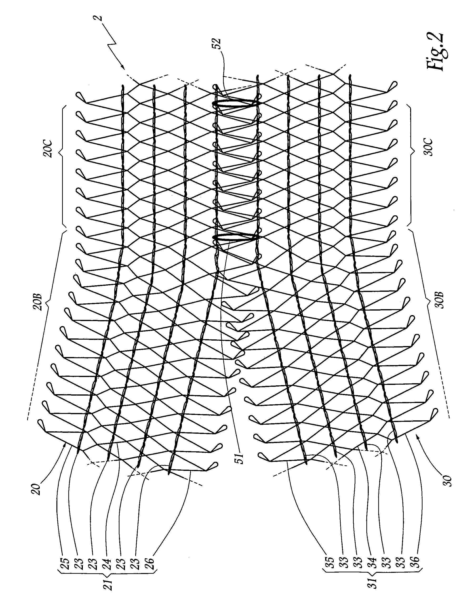 Implant for supporting the urethra of a man and a surgical kit for treating incontinence in a man and including such an implant