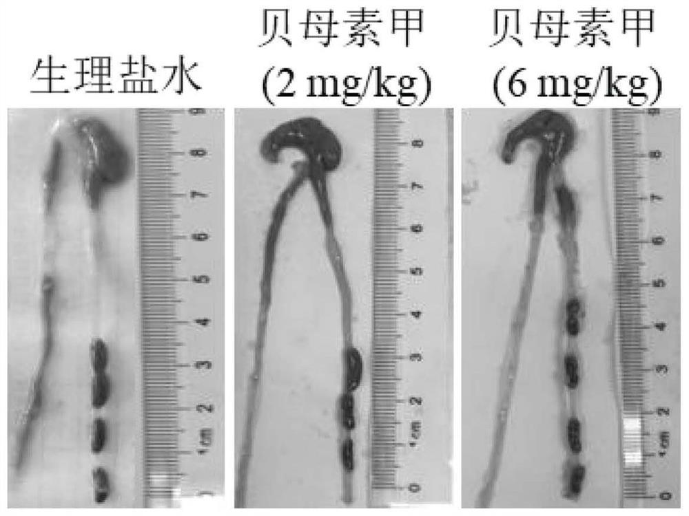 Application of peimine in preparation of medicine for preventing and/or treating ulcerative colitis