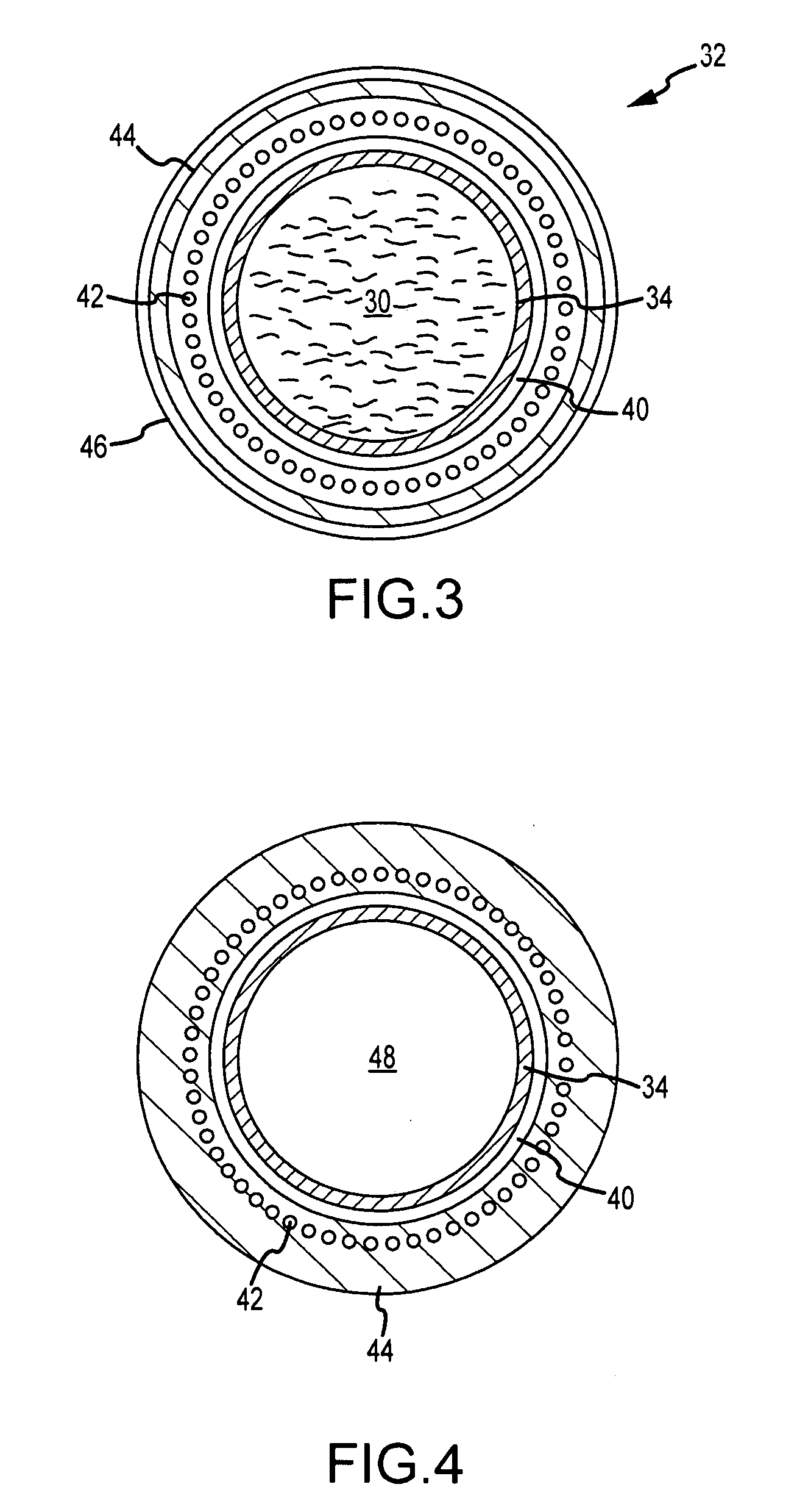 Catheter Having Independently-Deflectable Segments and Method of its Manufacture