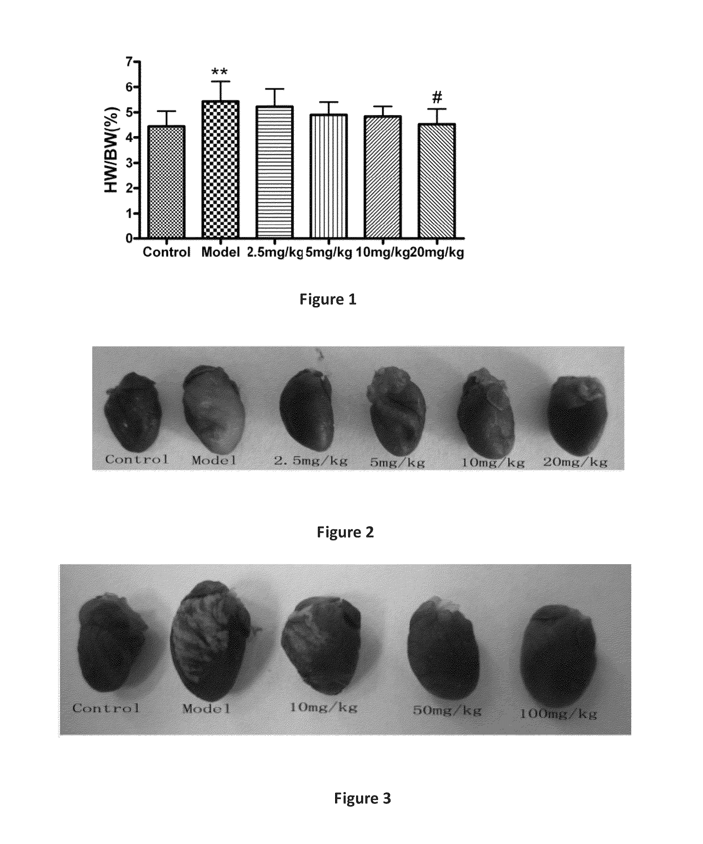 Line leaf inula flower lactone A and methods for preparing and using the same for treating myocarditis