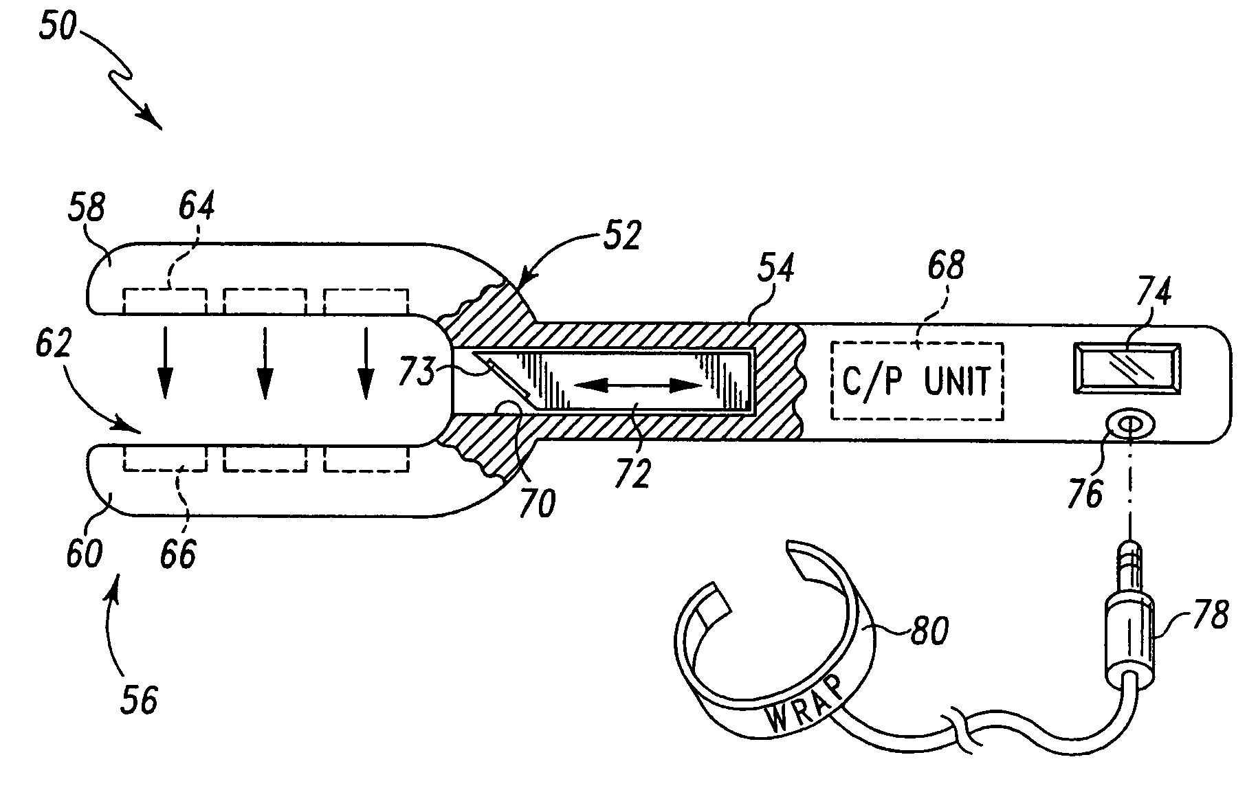 Surgical scalpel and system particularly for use in a transverse carpal ligament surgical procedure