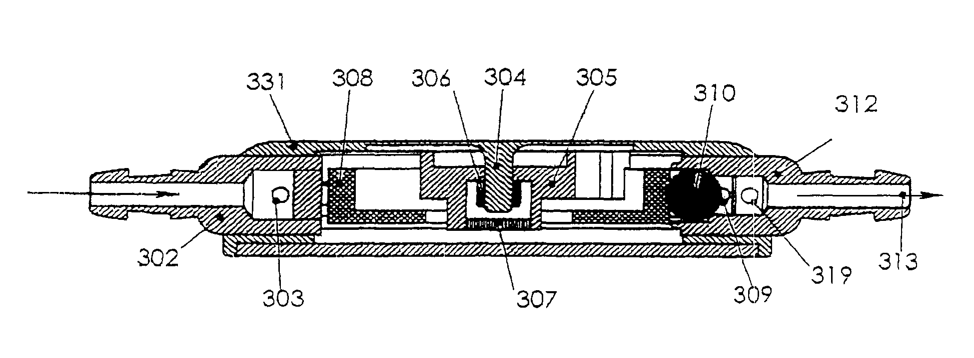 Adjustable hydrocephalus valve