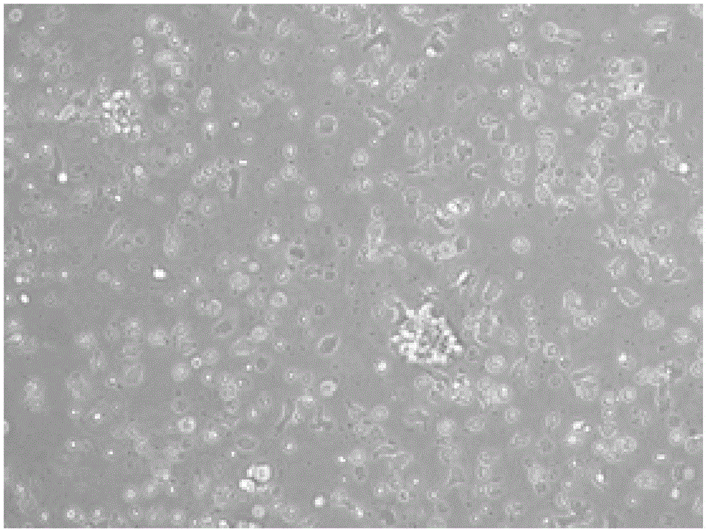 Method for cultivating lymph-node autologous CIK (cytokine-induced killer) cells and application of lymph-node autologous CIK cells