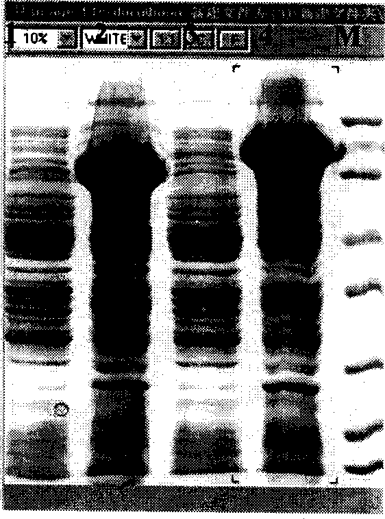 Recombination human endothelium chalene expression strain and solubility expression method