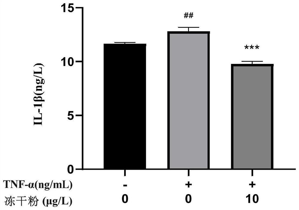 Traditional Chinese medicine composition for treating rheumatoid arthritis as well as preparation method and application thereof