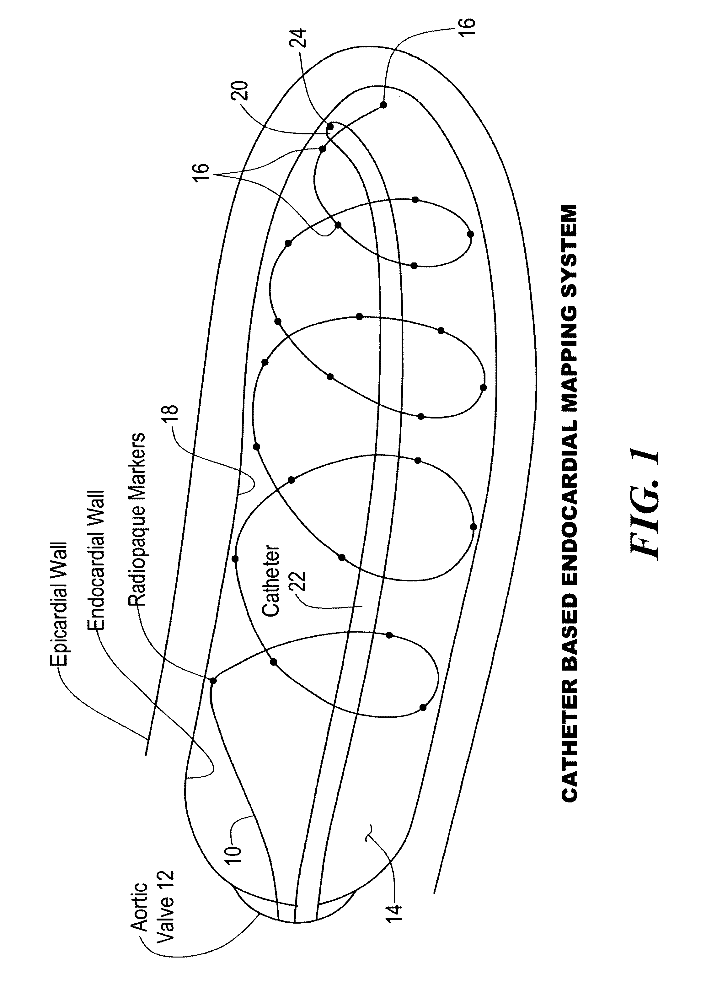 Percutaneous mapping system