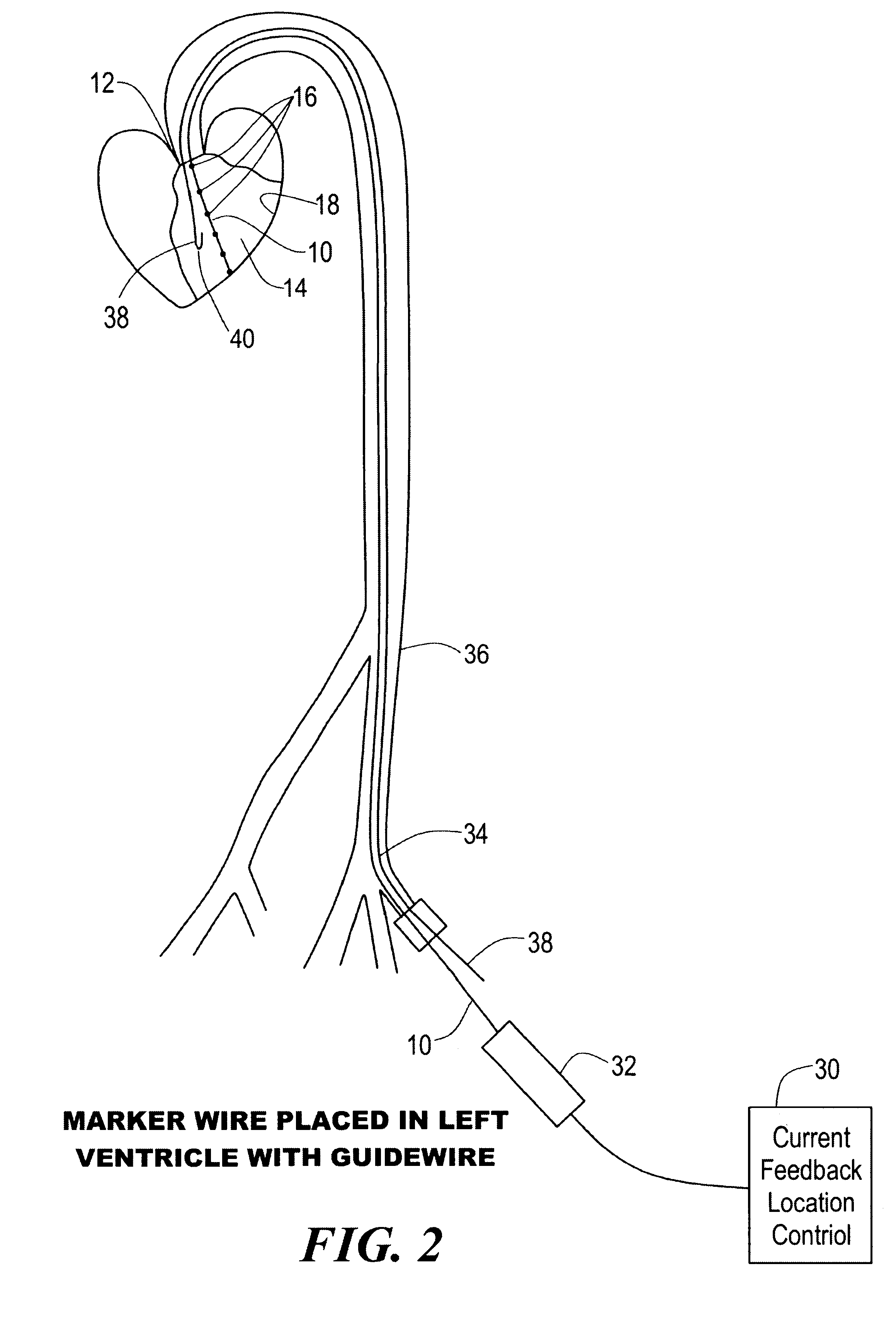 Percutaneous mapping system