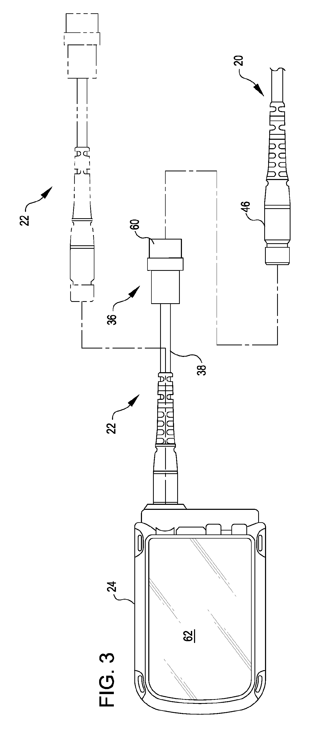 Modular Flying Lead Cable and Methods for Use With Heart Pump Controllers