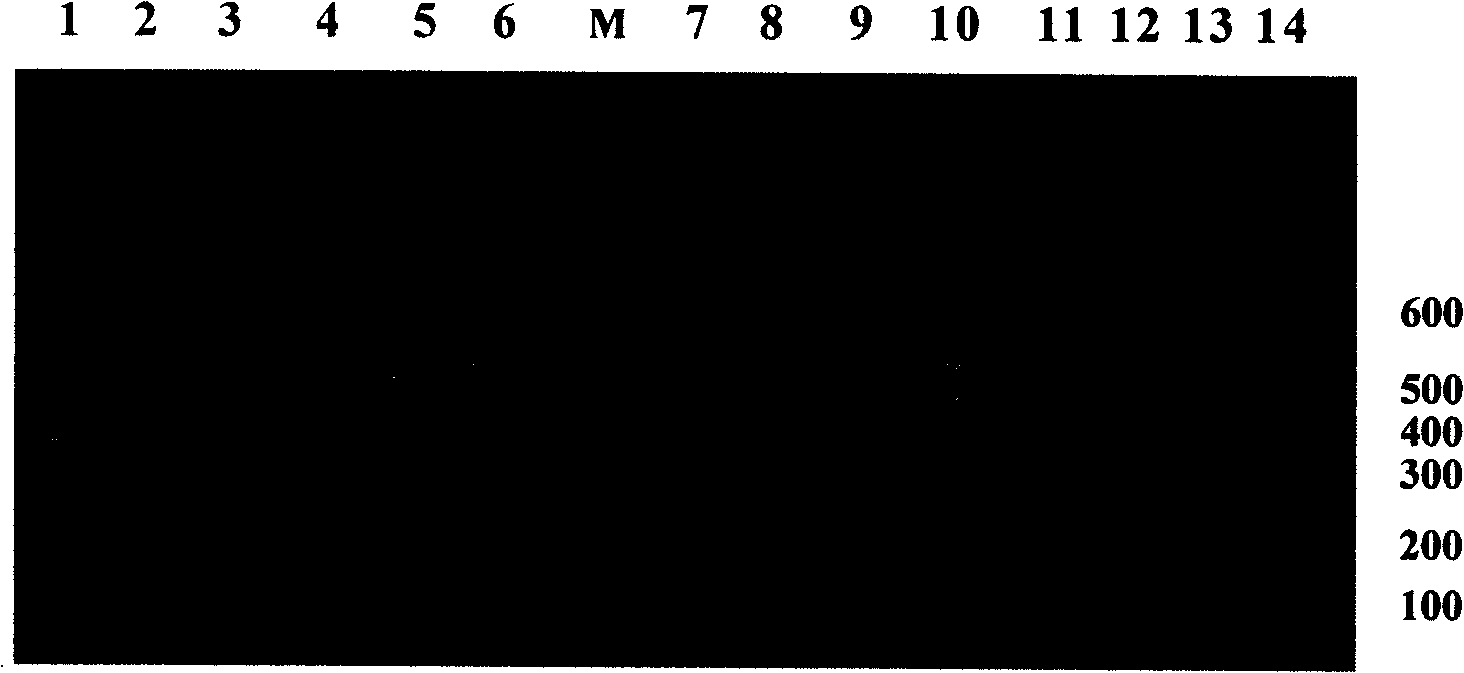 Process for preparing hybridoma cell for secreting anti-human asparagine hydroxylase monoclonal antibodies