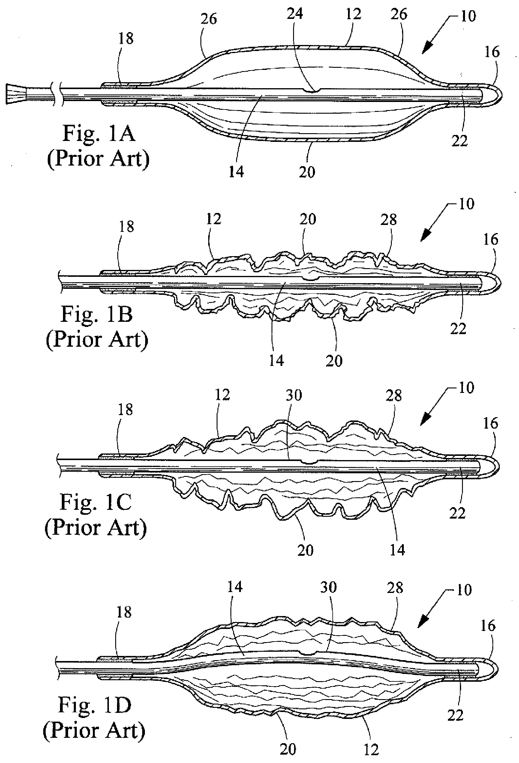 Non-buckling balloon catheter with spring loaded floating flexible tip