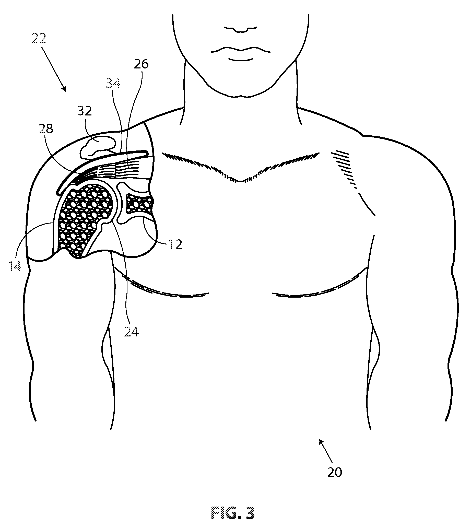 Methods and apparatus for deploying sheet-like materials