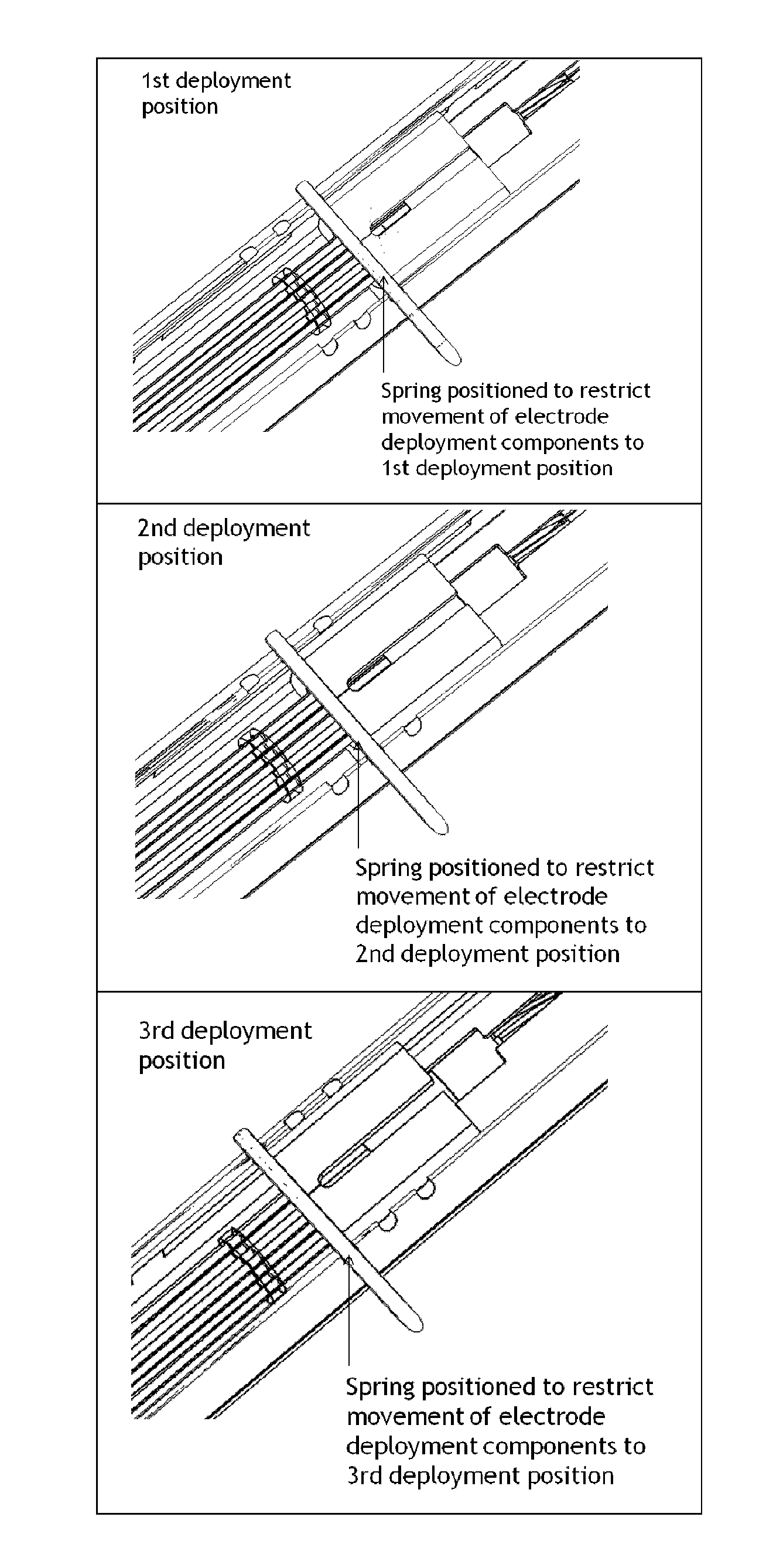 Method For Treating A Tissue Region With An Electric Field