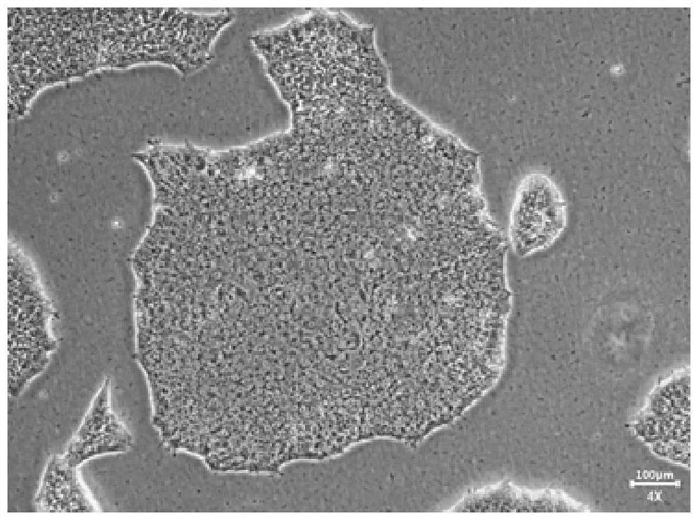 Culture solution and differentiation method for differentiating pluripotent stem cells into natural killer cells