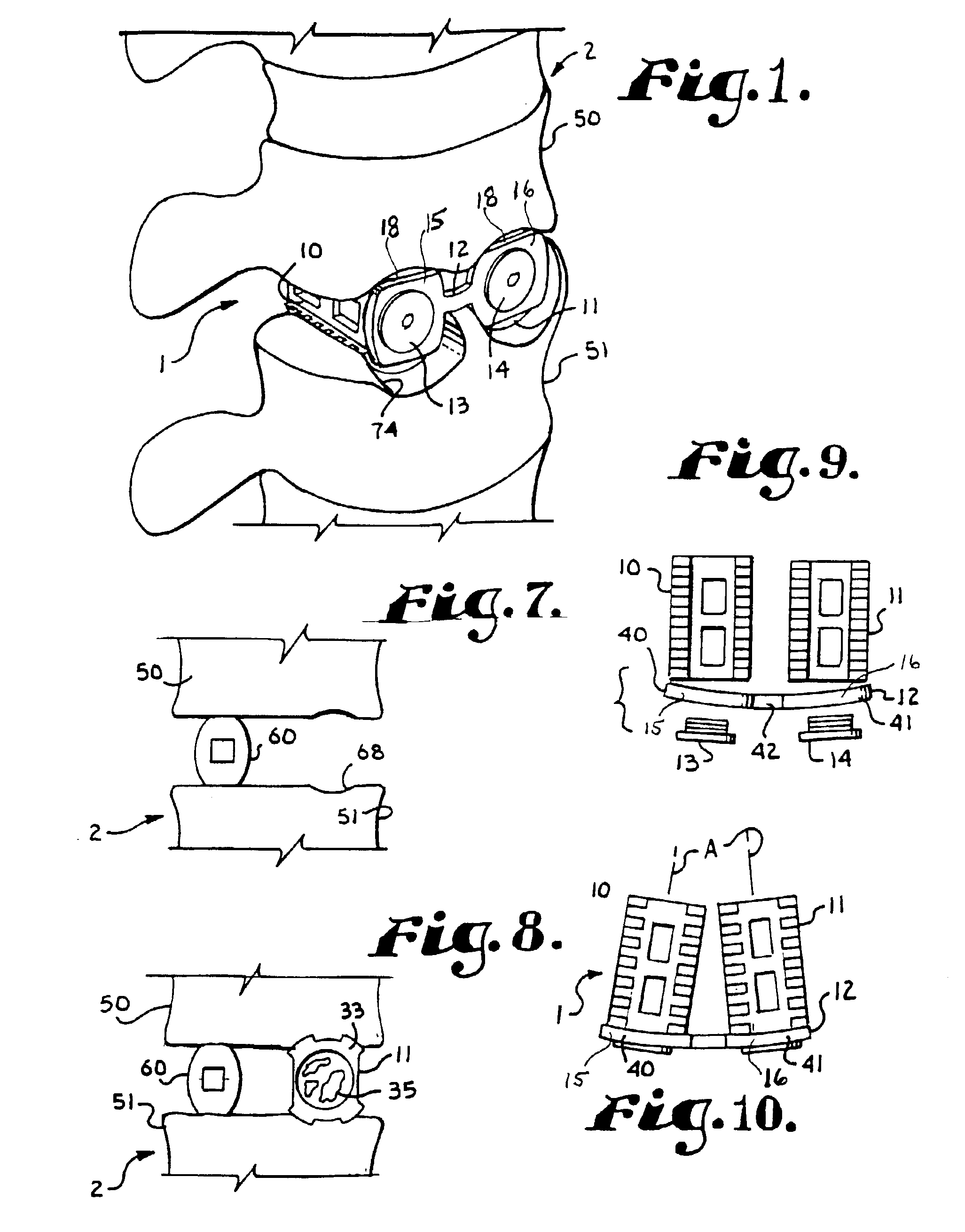 Spinal fusion apparatus and method