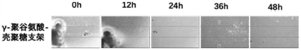 Preparation method of gamma-polyglutamic acid/chitosan microsphere scaffold