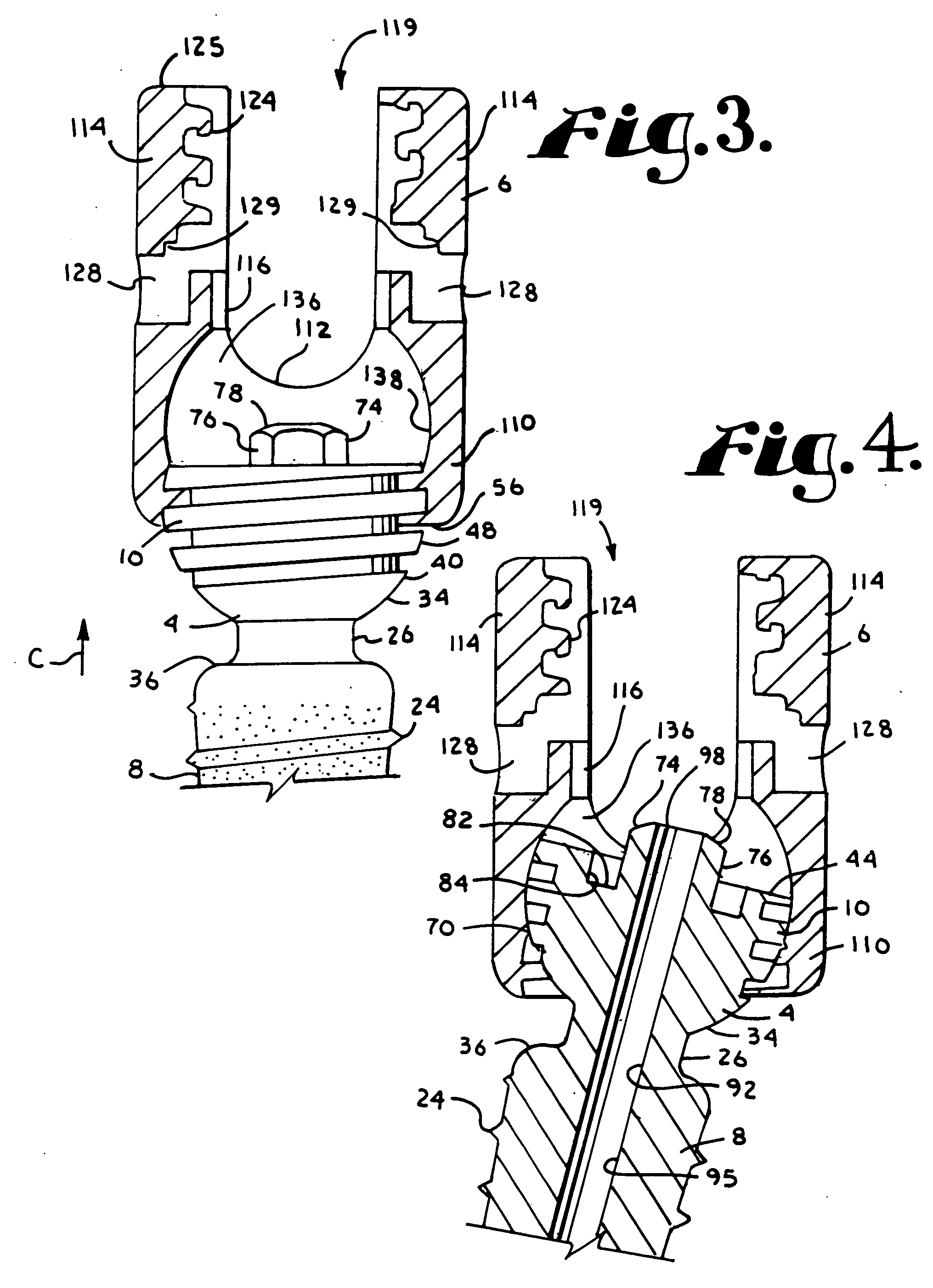 Dynamic stabilization medical implant assemblies and methods