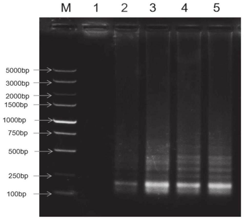 LAMP-LFD-based helicobacter pylori POCT detection kit and method