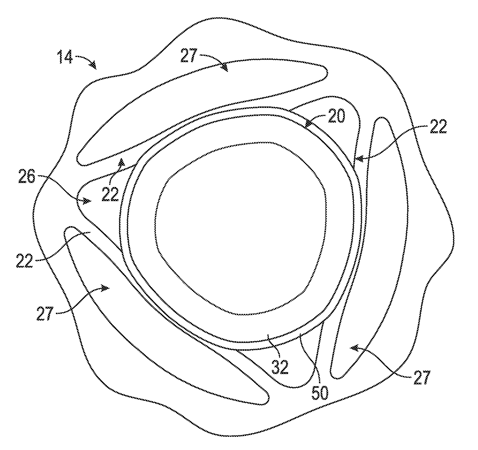 Serviceable aligning and self-retaining elastic arrangement for mated components and method