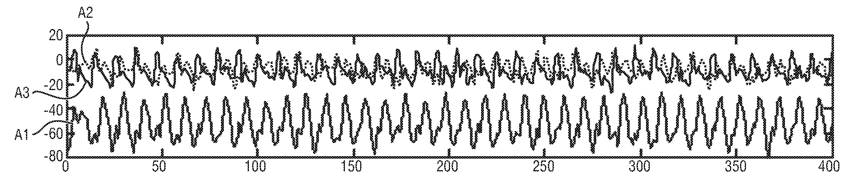 Device, method and system for counting the number of cycles of a periodic movement of a subject