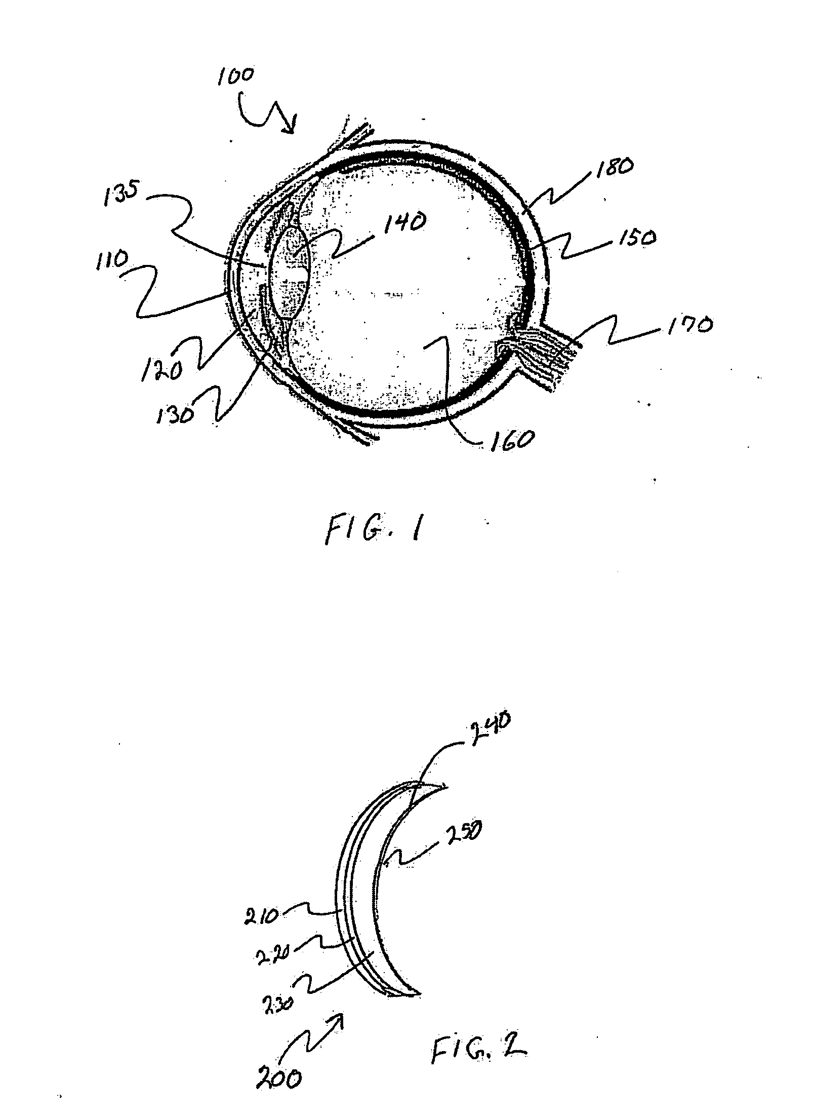 Mazaheri lasik method for visual enhancement