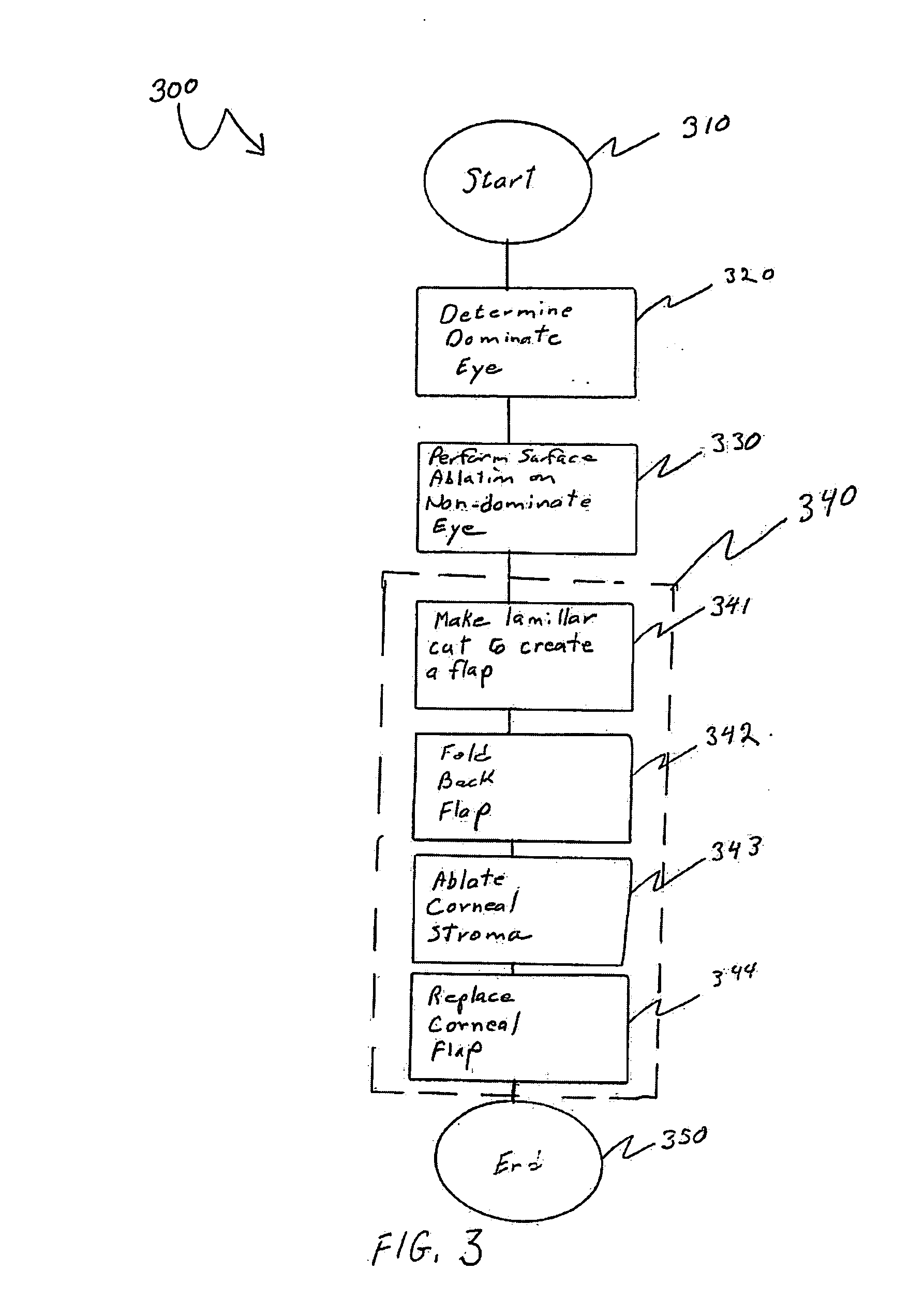 Mazaheri lasik method for visual enhancement