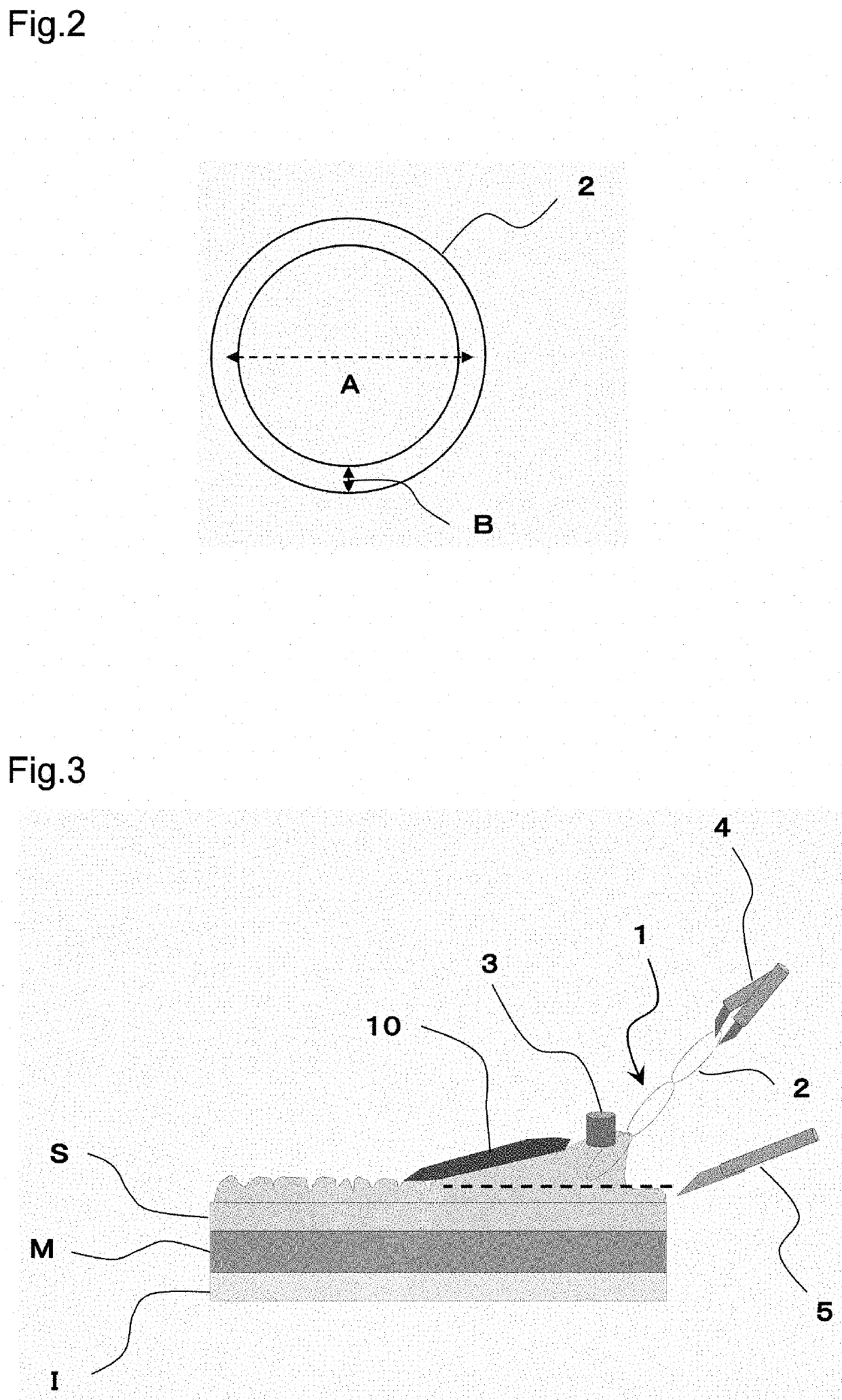 Detachable multi-ring traction device