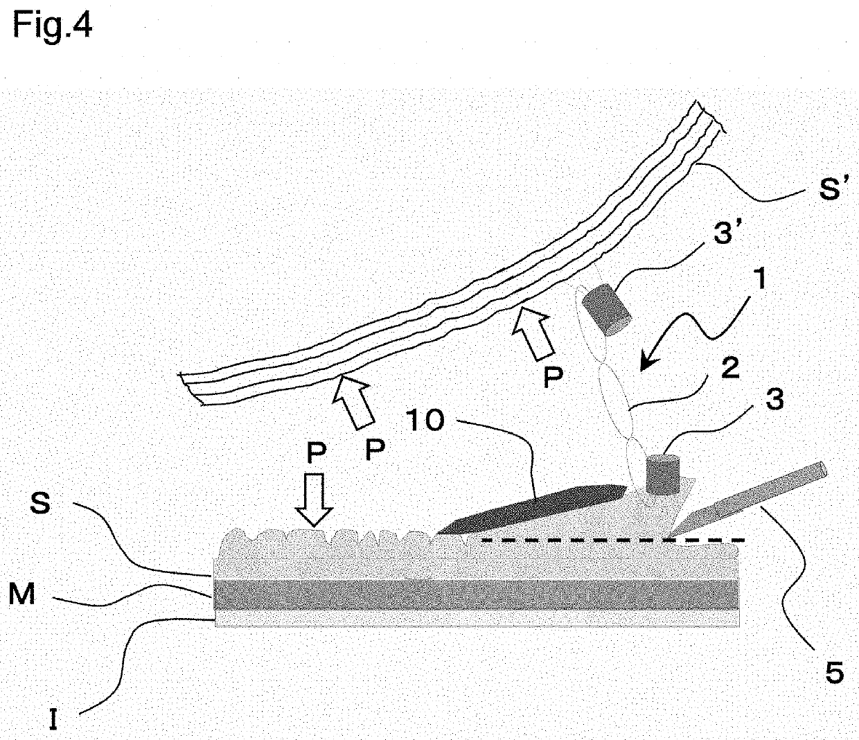 Detachable multi-ring traction device