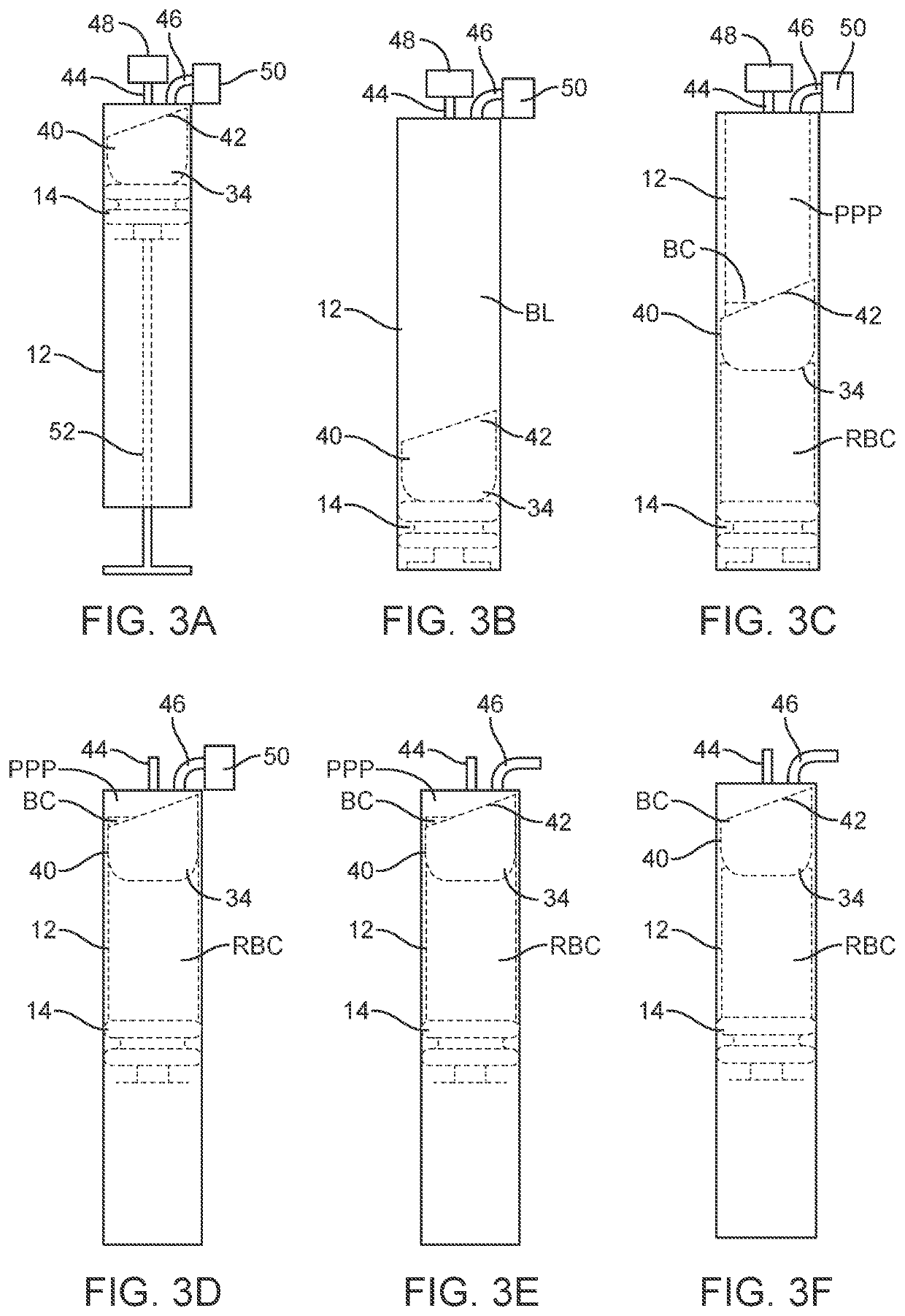 Apparatus and methods for concentrating platelet-rich plasma