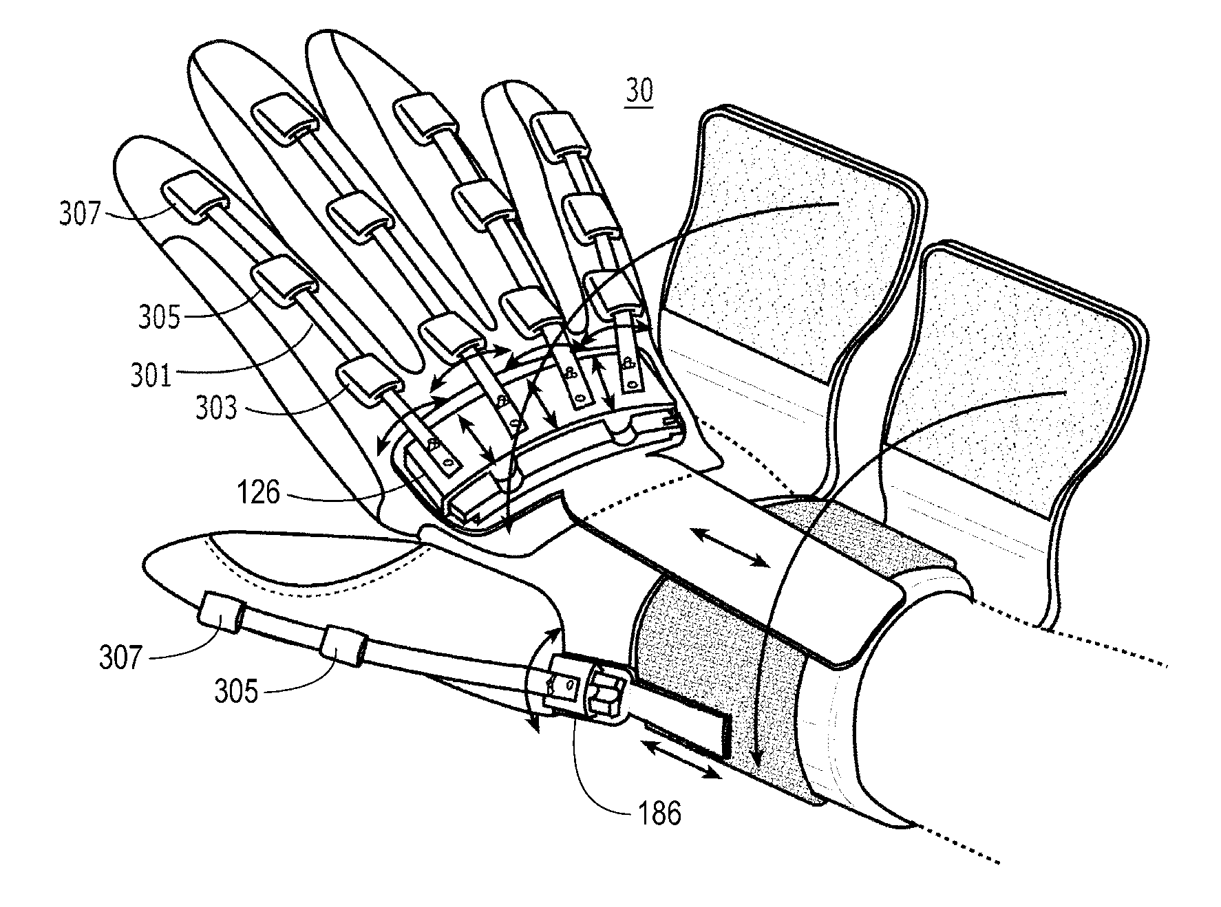 Dynamic hand splints