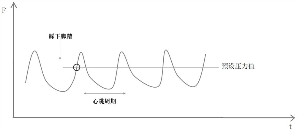 Catheter ablation system