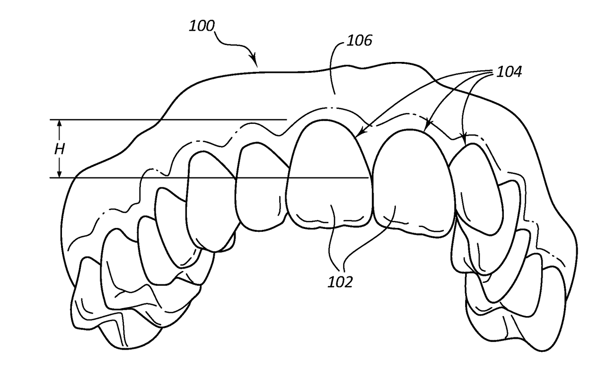 Dental Implants with Markers for Determining Three-Dimensional Positioning