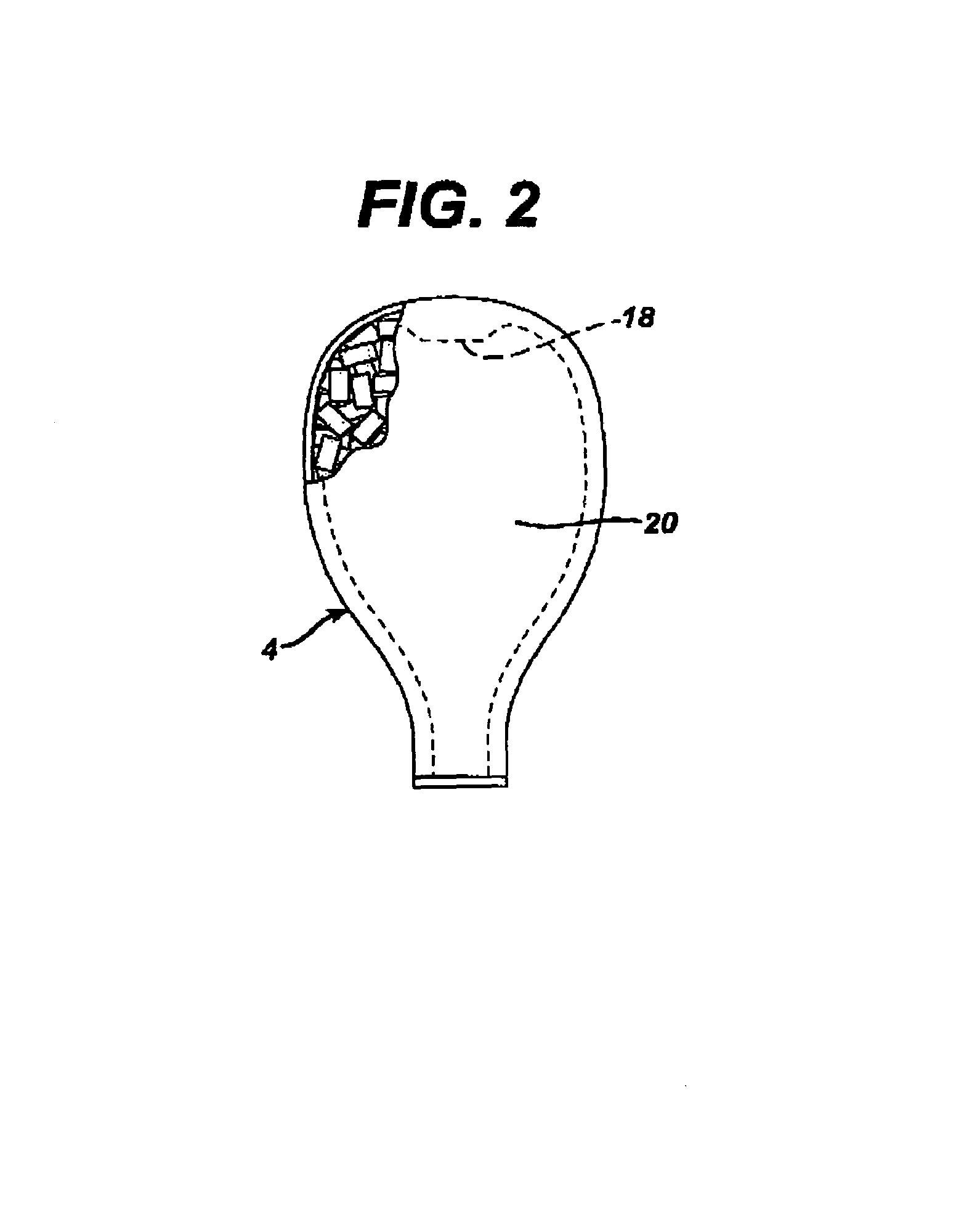 Removal string attachment for intravaginal devices