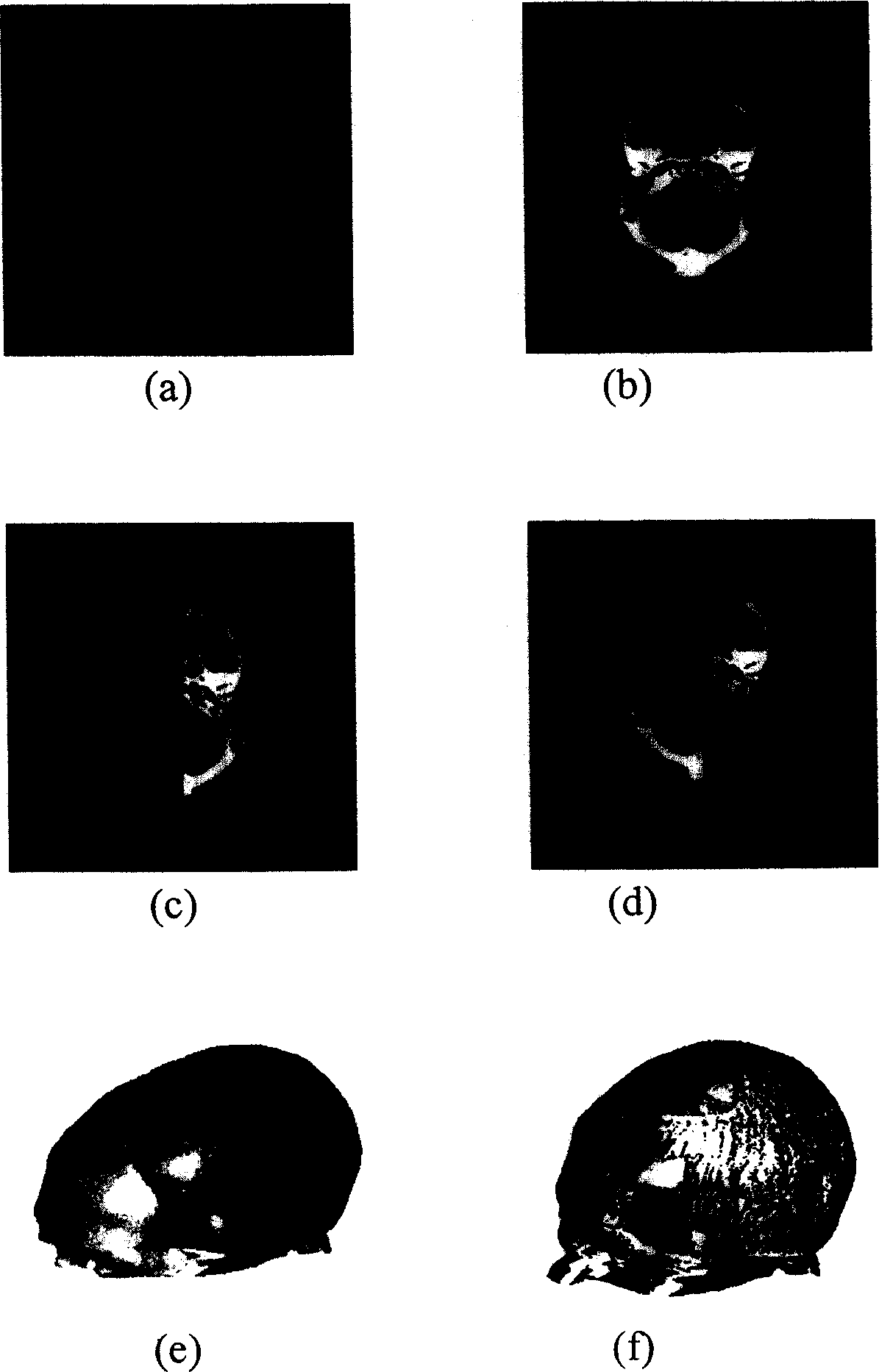 Multiple modality medical image registration method based on mutual information sensitive range