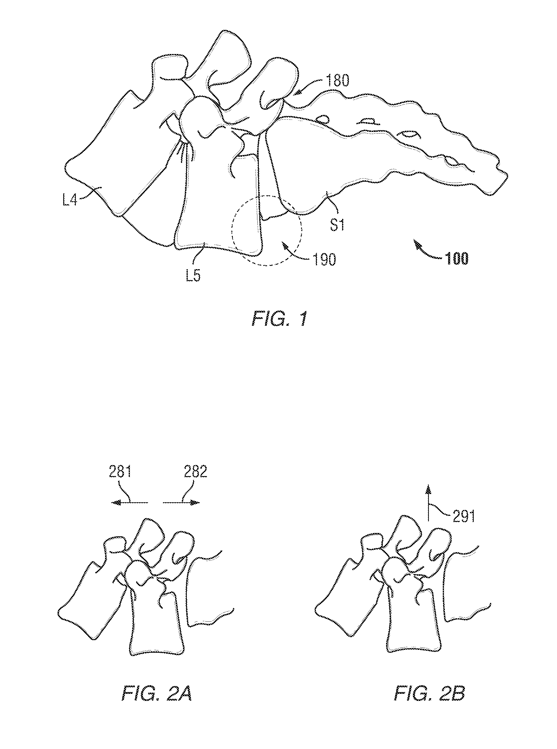 Surgical instrument with integrated compression and distraction mechanisms