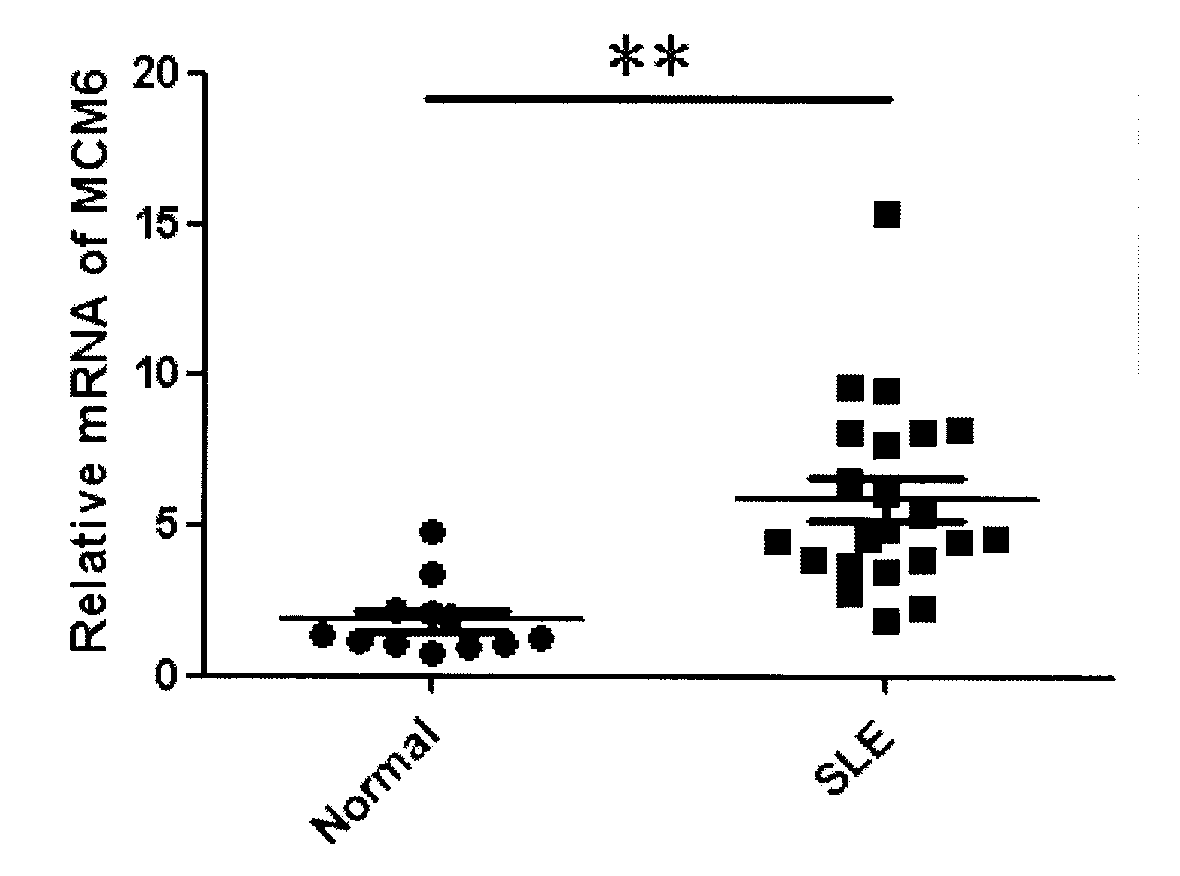 Function of mini-chromosome maintenance complex component in disease diagnosis and prevention of systemic lupus erythematosus