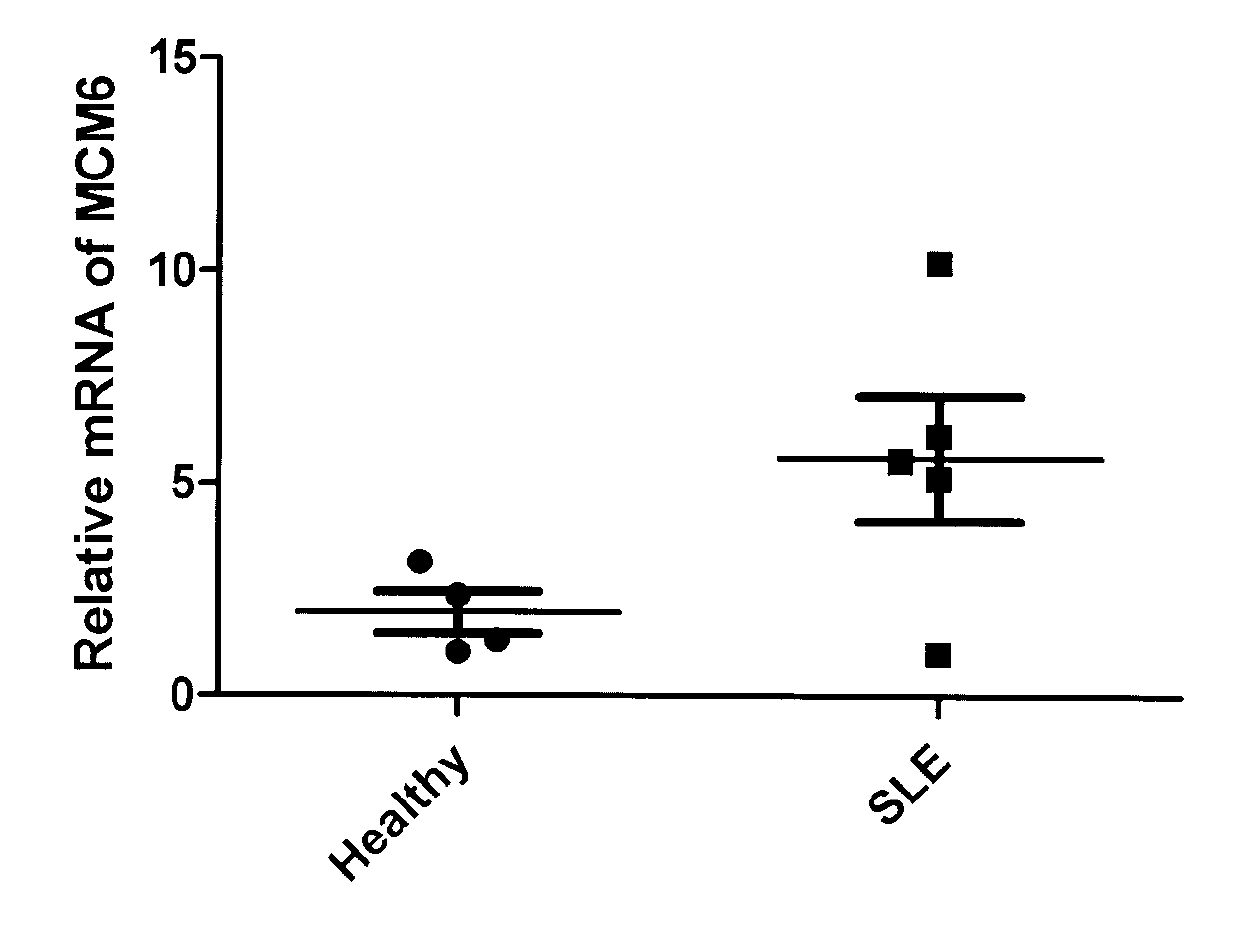 Function of mini-chromosome maintenance complex component in disease diagnosis and prevention of systemic lupus erythematosus