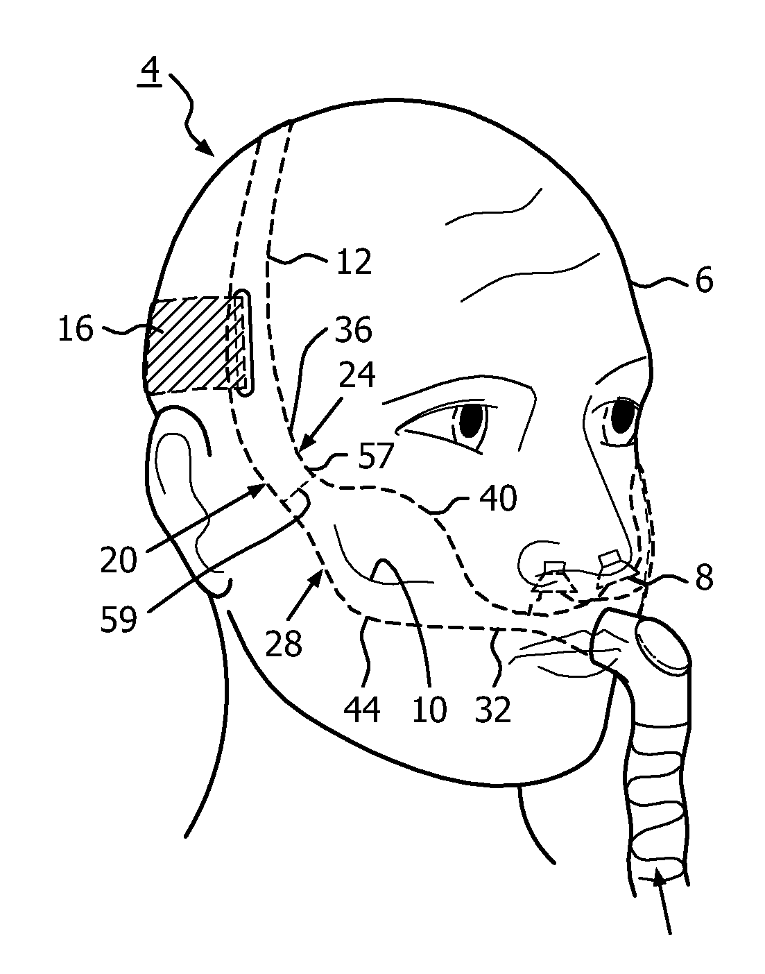 Headgear apparatus for nasal interface