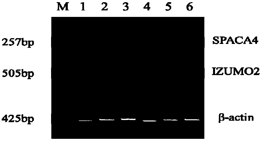 Sperm protein marker IZUMO2 closely related to reproductive performance of service boar and application of sperm protein marker IZUMO2