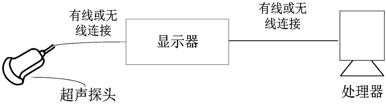 Ultrasonic image marking method and device, processor and readable storage medium